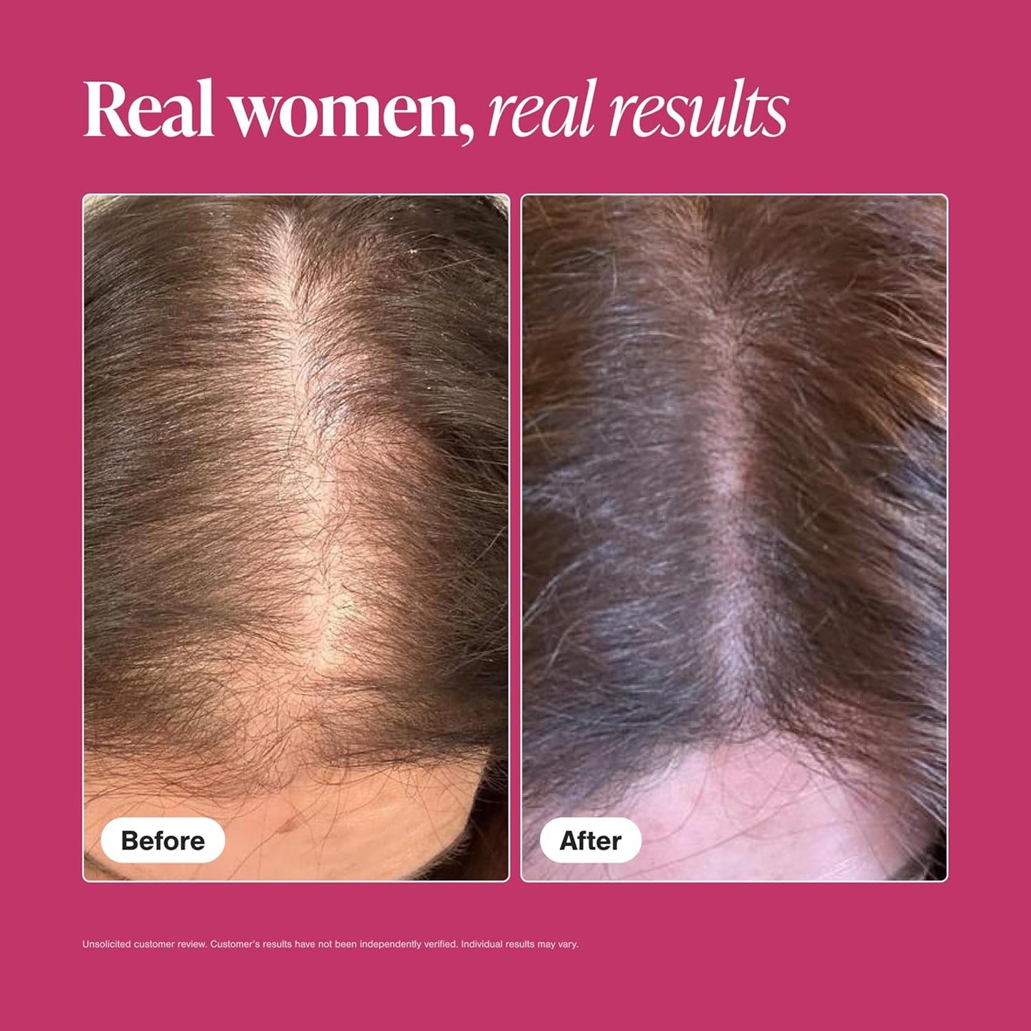 Hair Growth Supplements for Women for Thicker, Fuller Hair, Nourishes Thinning & Loss, with Proprietary Collagen Complex, 60 Tablets, 1 Month Supply