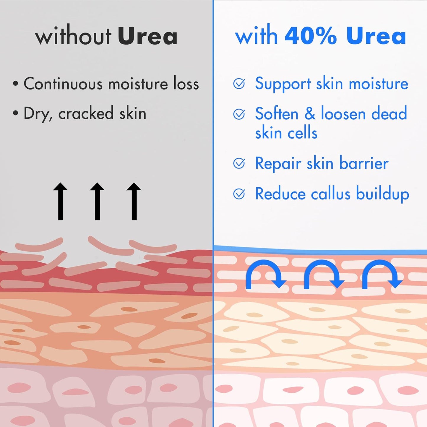 Urea Cream 40% plus Salicylic Acid 2%, Foot Cream for Dry Cracked Heels Feet Knees Elbows Hands, Foot Dead Skin Cuticle Callus Remover Toenail Softener, Keratolytic Skin Barrier Repair