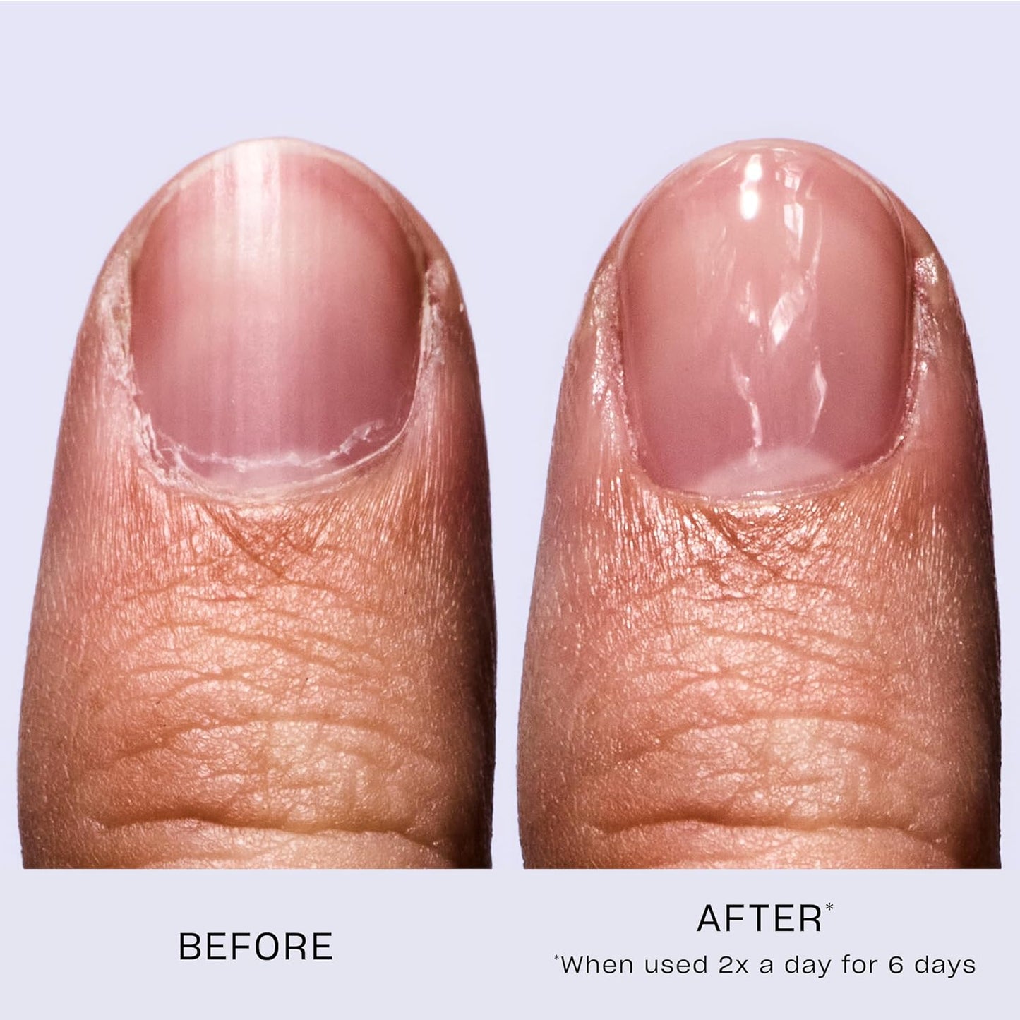 Nail Envy Nail Strengthener | Clear & Opaque Crème Nail Polish Treatment | Strengthen Weak & Thin Nails