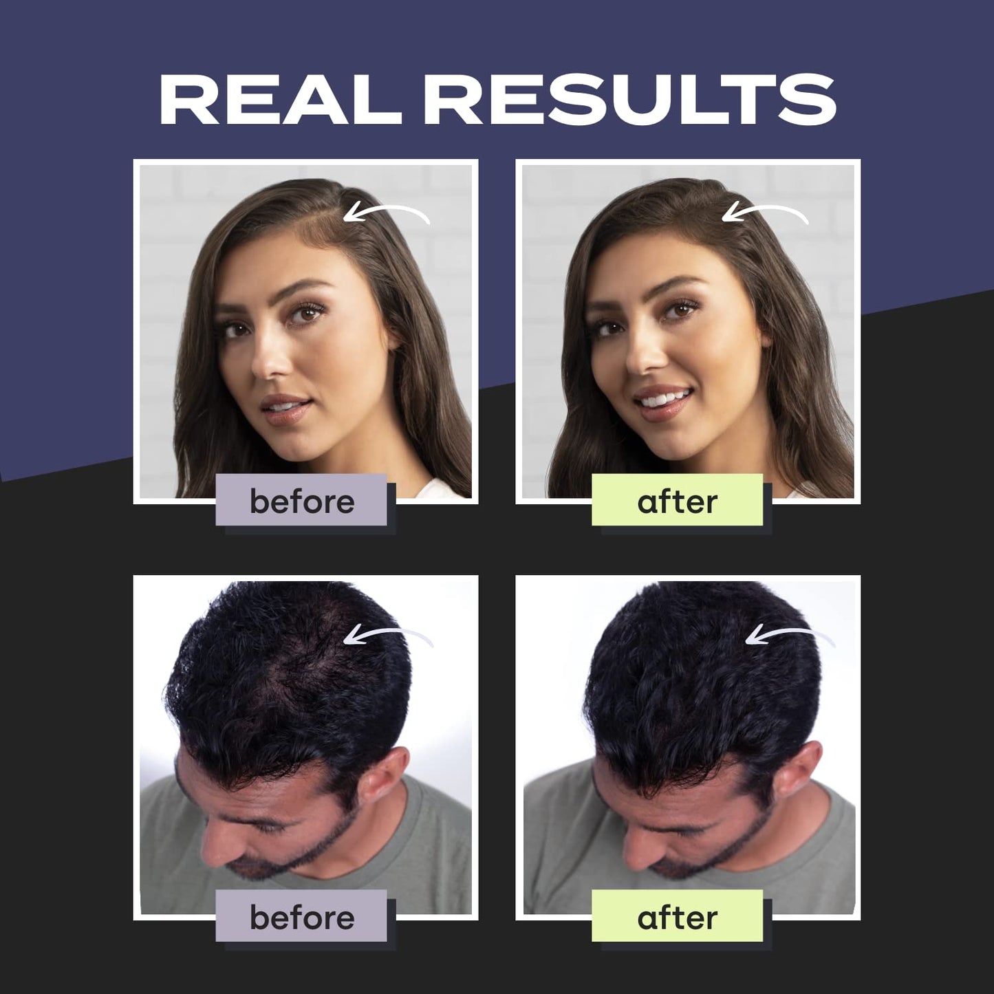 Toppik Hair Building Fibers, Fill in Fine or Thinning Hair Instantly Thicker, Fuller Looking Hair 9 Shades,4 Size Options