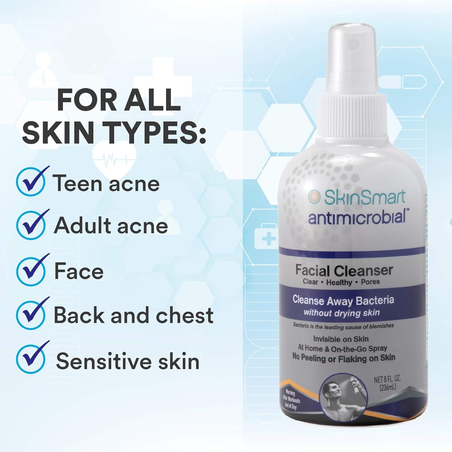 Skinsmart Facial Cleanser for Breakouts, Targets Bacteria for Post-Workout Pimples, Blemishes and Sweat Irritation; 8 Oz Spray, Safe for All Ages: Adults and Teens